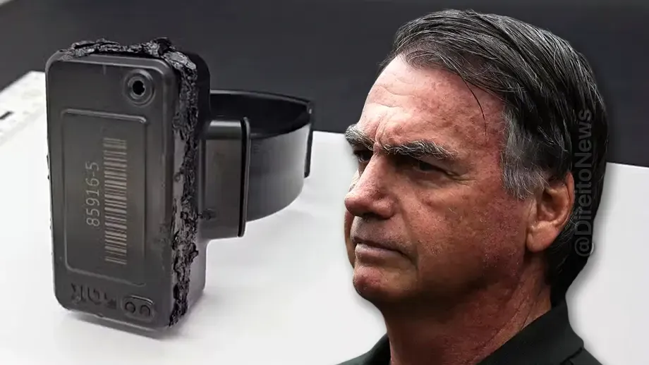 imagens ineditas mostram ficou tornozeleira queimada bolsonaro ferro solda